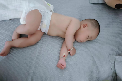 德清宝宝褶皱处擦粉还是油